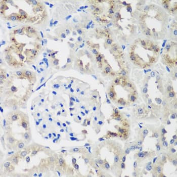Polyclonal Rabbit anti-Human NEDD4L / NEDD4-2 Antibody (IHC, WB)