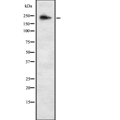 ALPK3 Antibody