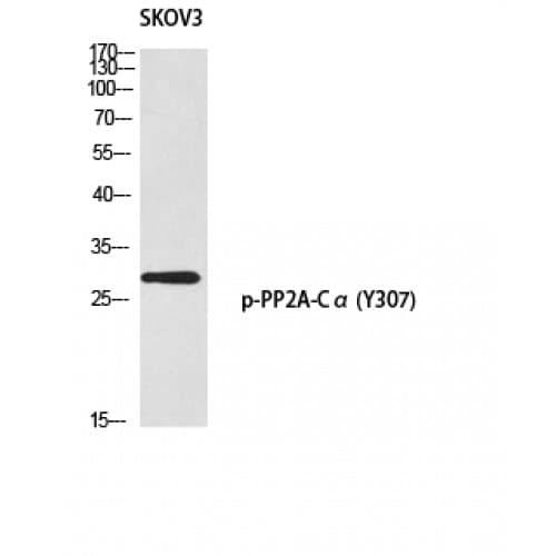 PP2Ac / PPP2CA Antibody (250-330 aa)