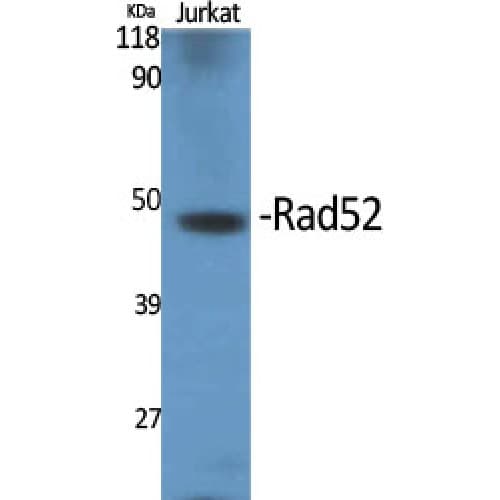 RAD52 Antibody (40-120 aa)