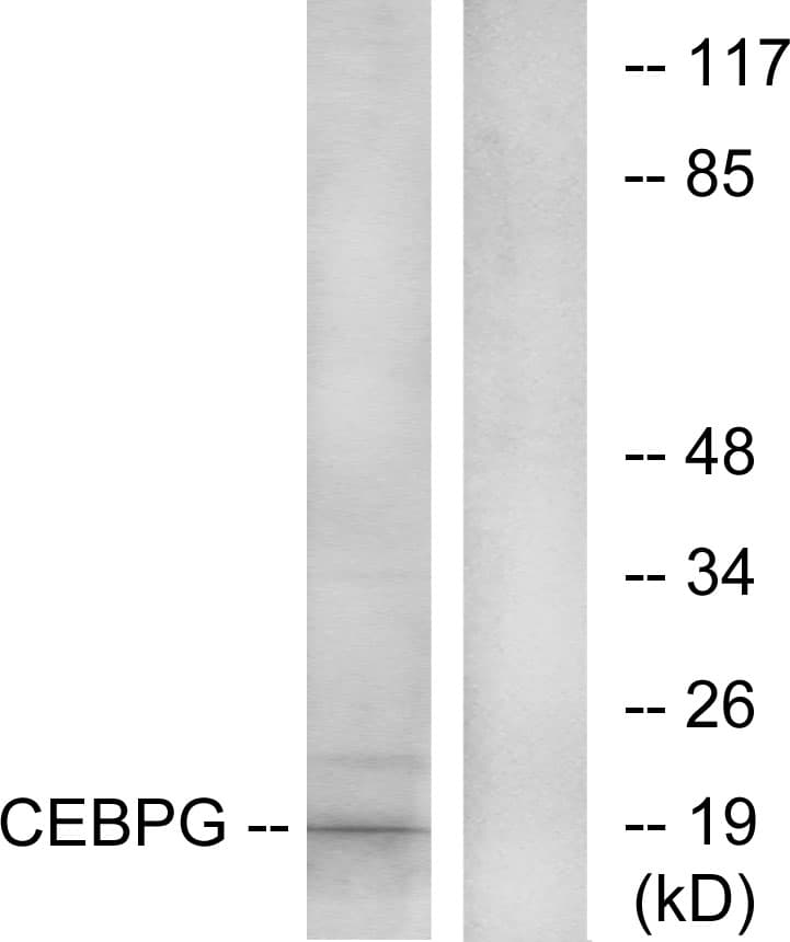 CEBPG / CEBP Gamma Antibody (aa31-80)