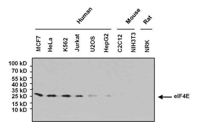 Monoclonal Mouse anti-Human EIF4E Antibody (clone 5D11, IF, WB)