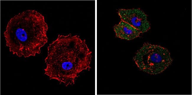 Monoclonal Mouse anti-Human EIF4E Antibody (clone 5D11, IF, WB)