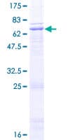 Human WNT4 Protein (Recombinant GST)