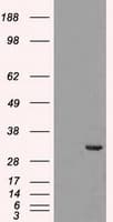 Monoclonal Mouse anti-Human CDK5 Antibody (clone OTI2H6, IF, WB)