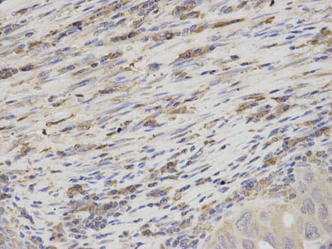 IHC-plus™ TS / Thromboxane Synthase Antibody