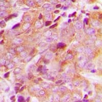 Polyclonal Rabbit anti-Human CEP76 Antibody (Internal, IHC, WB)