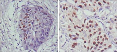 Tumor suppressor p53 Antibody (clone 4A8)