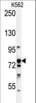 Polyclonal Rabbit anti-Human RPS6KA1 / RSK1 Antibody (IHC, WB)