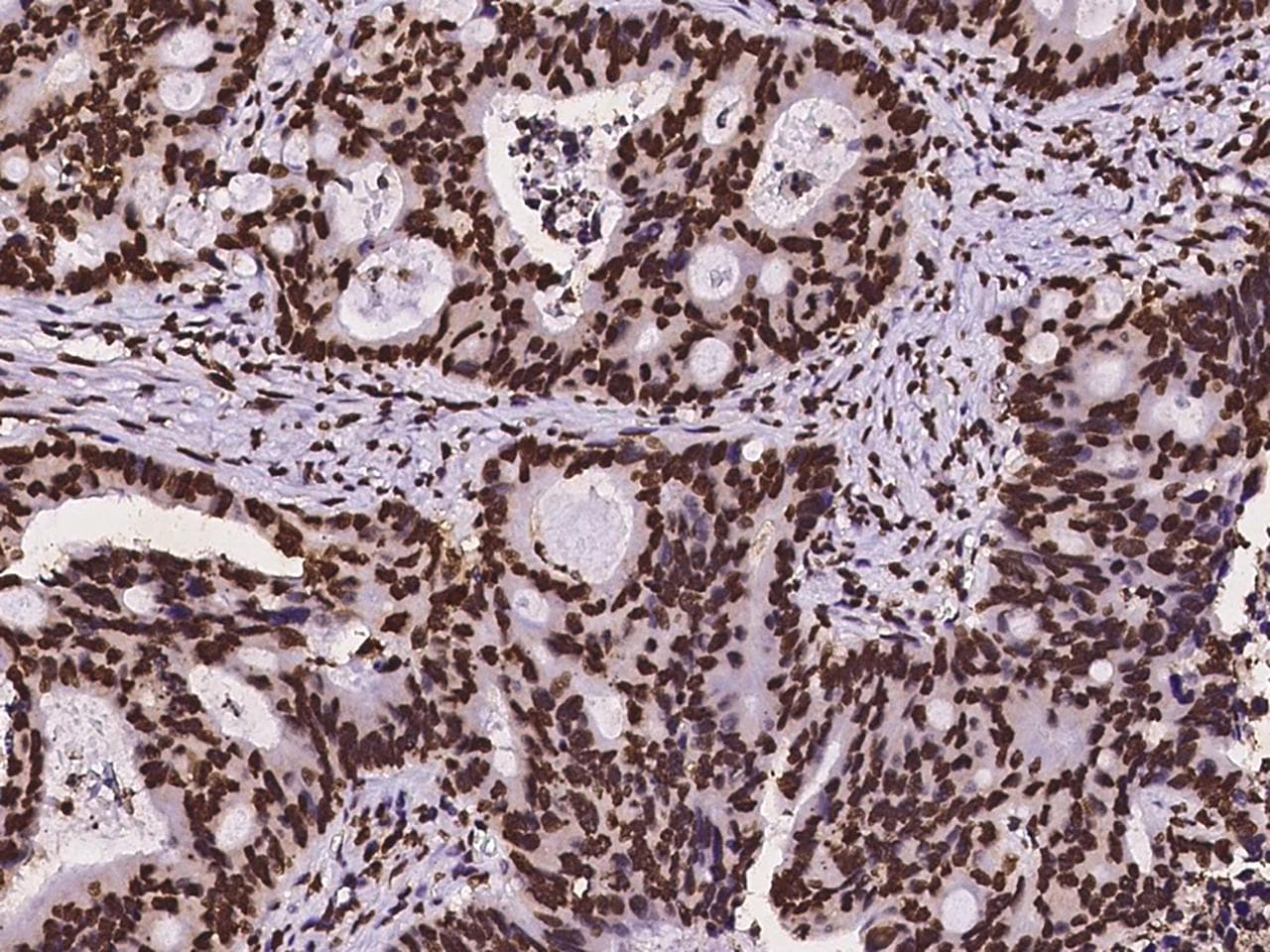 HIST1H3A Antibody (Preservative Free)