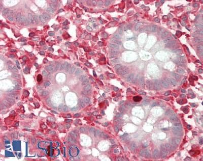FUT4 / CD15 Antibody (aa264-497)