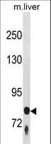 F13B / TGase Antibody (aa151-179)