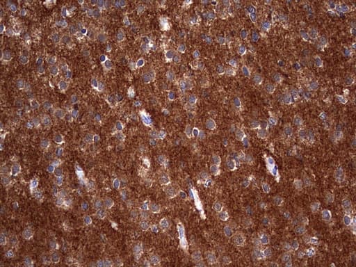 NUMB Antibody (aa1-365, clone OTI1B5)
