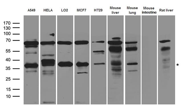 Polyclonal Rabbit anti-Human NTHL1 Antibody (WB)