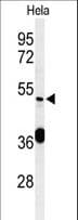 Polyclonal Rabbit anti-Human DDX49 Antibody (aa385-413, IHC, WB)