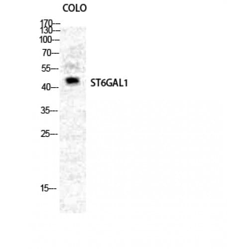 Polyclonal Rabbit anti-Human ST6GAL1 / CD75 Antibody (140-220 aa, Internal, IHC, WB)