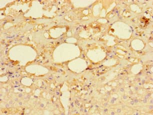 Polyclonal Rabbit anti-Human MRPS28 Antibody