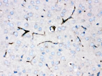 CP / Ceruloplasmin Antibody