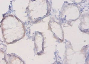 PLXNA1 / Plexin A1 Antibody