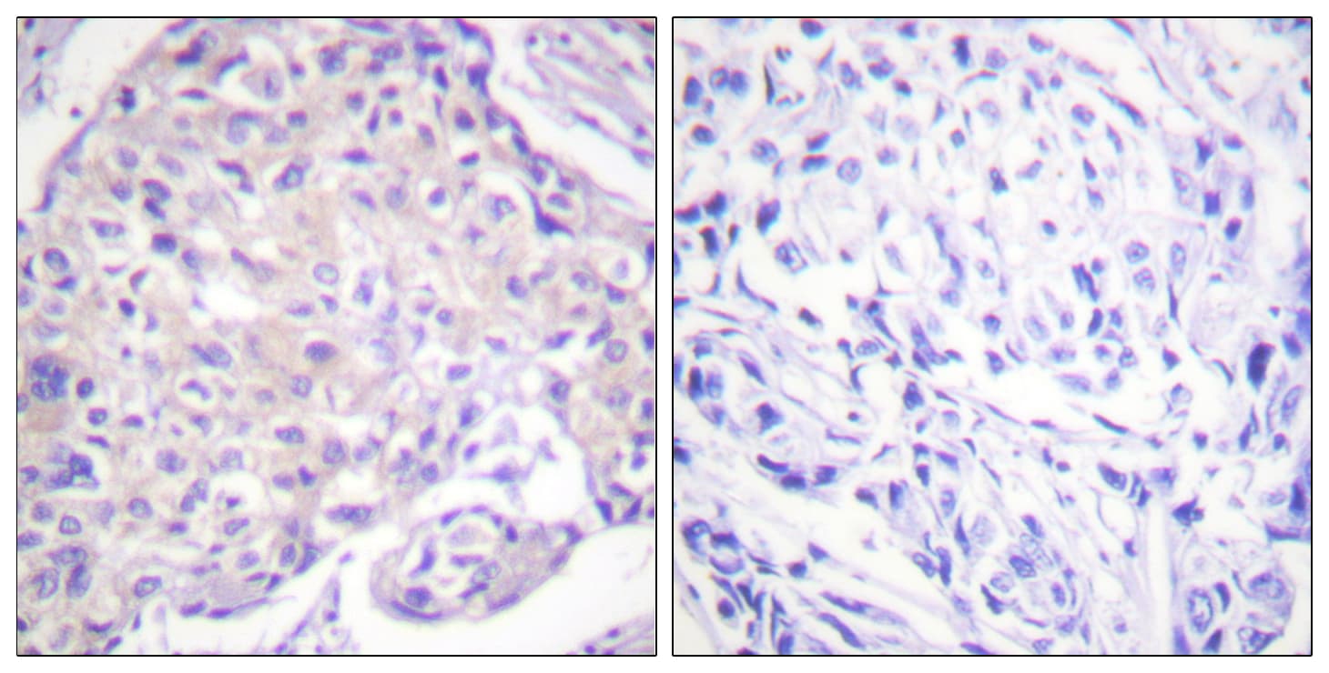 PAK1 Antibody (phospho-Thr212)