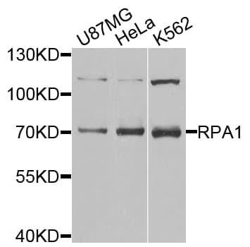 RPA70 / RPA1 Antibody
