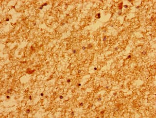 Polyclonal Rabbit anti-Human MARS2 Antibody (IHC, WB)