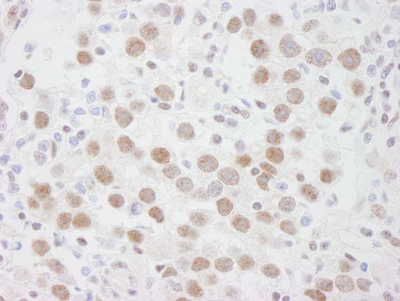 Polyclonal Rabbit anti-Human DDX1 Antibody (aa500-550, IHC)