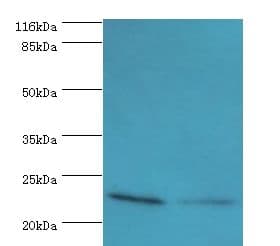 HsT19268 / MTHFS Antibody (aa2-203)