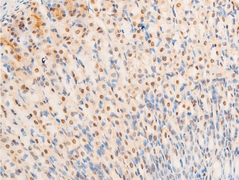 NR3C1/Glucocorticoid Receptor Antibody (phospho-Ser226)