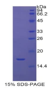 Human HIST2H3A Protein (Recombinant His)
