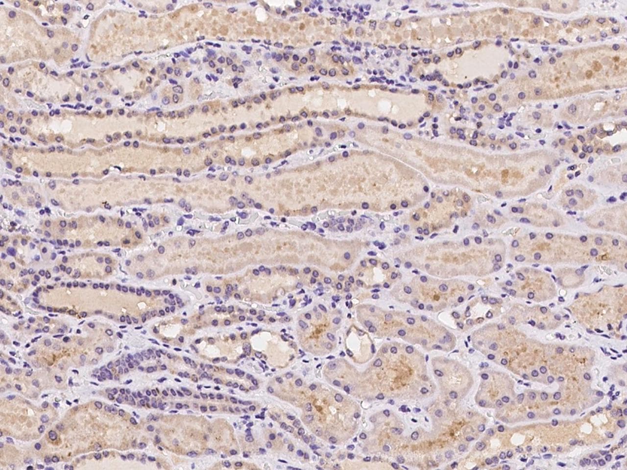 N4BP2 Antibody