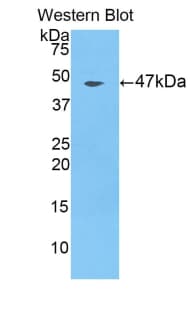 FOLR1 / Folate Receptor Alpha Antibody (aa25-234, APC)