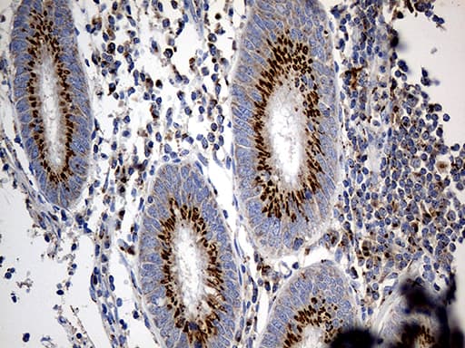 PTPN22 / PEP Antibody (aa359-449, clone OTI6B1)