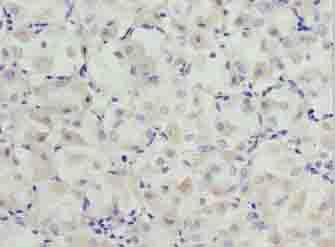 IHC-plus™ Polyclonal Rabbit anti-Human SLC31A2 Antibody (IHC)