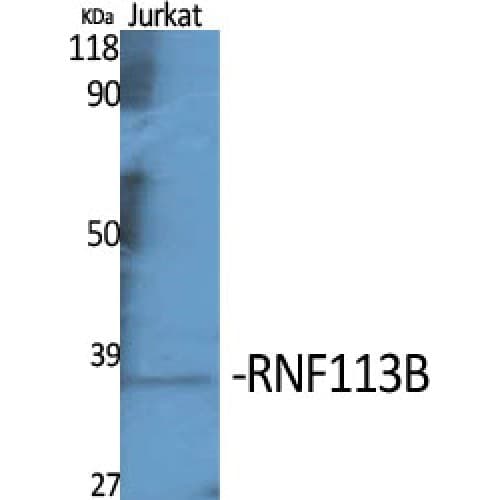 RNF113B Antibody (Internal)