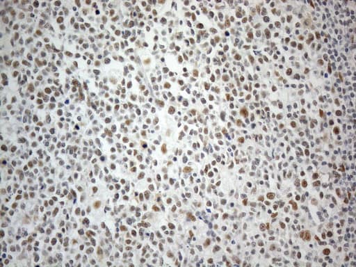 Monoclonal Mouse anti-Human CWC27 Antibody (clone OTI4C8, Carrier-free, aa145-472, IHC, WB)
