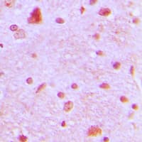 ARNT2 Antibody (N-Terminus)