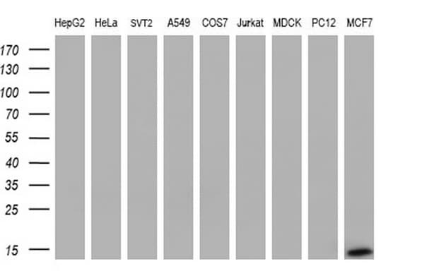 S100A9 / MRP14 Antibody (clone OTI13E12)