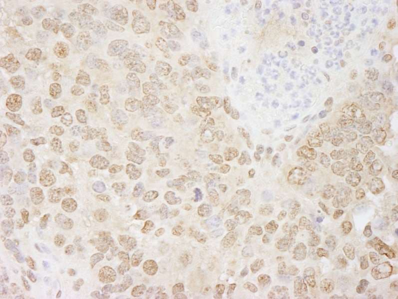 CHUK / IKKA / IKK Alpha Antibody (aa350-400)