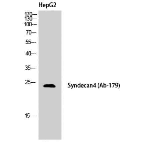 Polyclonal Rabbit anti-Human SDC4 / Syndecan 4 Antibody (120-200 aa, IHC, IF, WB)