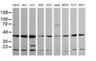 MAP2K1 / MKK1 / MEK1 Antibody (clone OTI4E1)