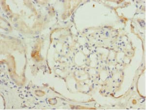 CCT2 / CCT Beta Antibody