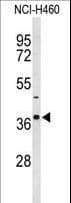 SLC25A17 Antibody (aa17-44)