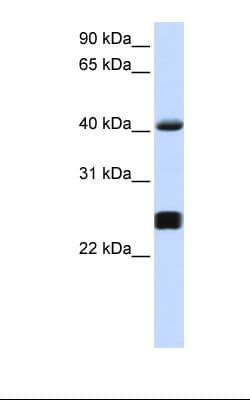 PathPlus™ Alpha-1-Antichymotrypsin Antibody (aa254-303)