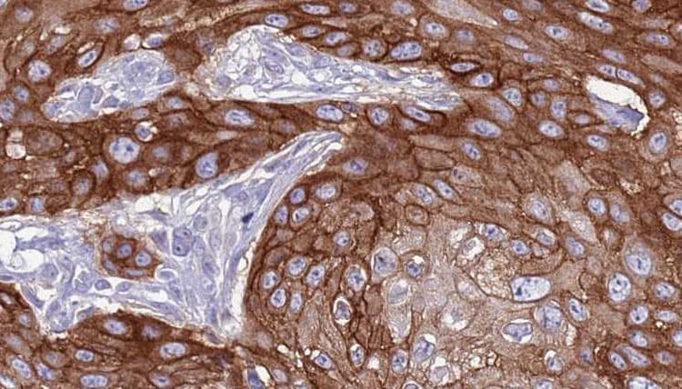 Rhodopsin Kinase / GRK1 Antibody