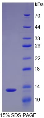 Pig IL8 / Interleukin 8 Protein (Recombinant His-T7)