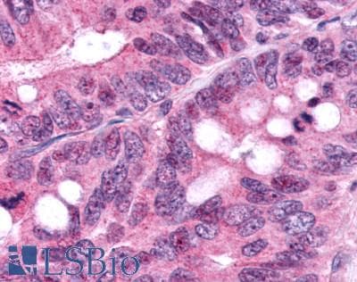PathPlus™ FAK / Focal Adhesion Kinase Antibody (Internal)