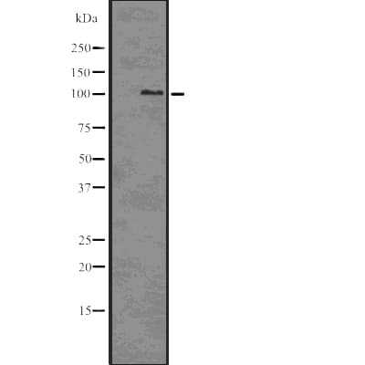 CTNNA1 / Catenin Alpha-1 Antibody (phospho-Ser655,pThr658)