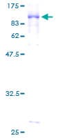Human GGA2 Protein (Recombinant GST)