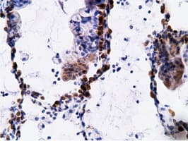 EPHX2 / Epoxide Hydrolase 2 Antibody (clone OTI1H5)